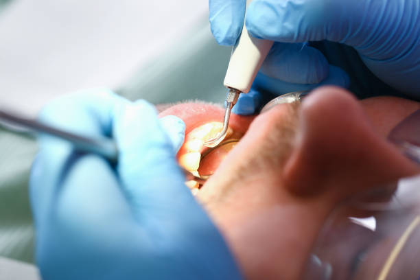 Best Emergency Dental Care for Trauma or Injury in Enterprise, WV