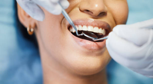 Best Emergency Wisdom Teeth Removal in Enterprise, WV